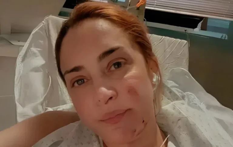 Las impactantes fotos de María Julia Oliván: así le quedó la cara tras el accidente que casi le cuesta la vida